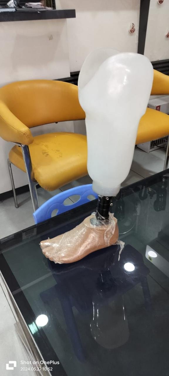 BELOW KNEE PROSTHETIC